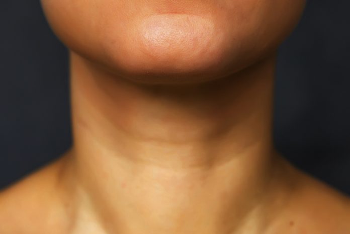Treating Thyroid Disease