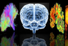 Natural speech, dementia risk and what retailers need to know about brain health